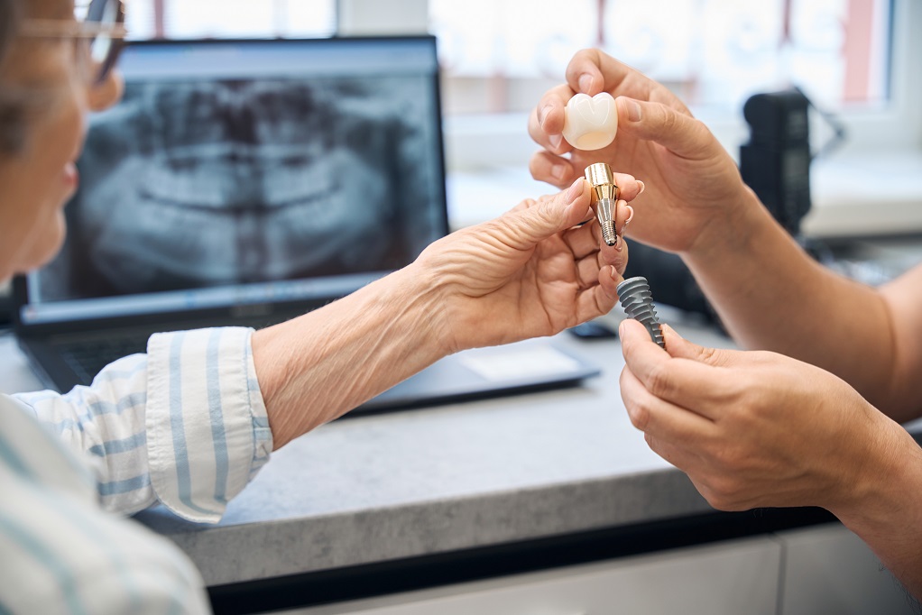 Etapy implantacji zęba – poznaj przebieg procesu
